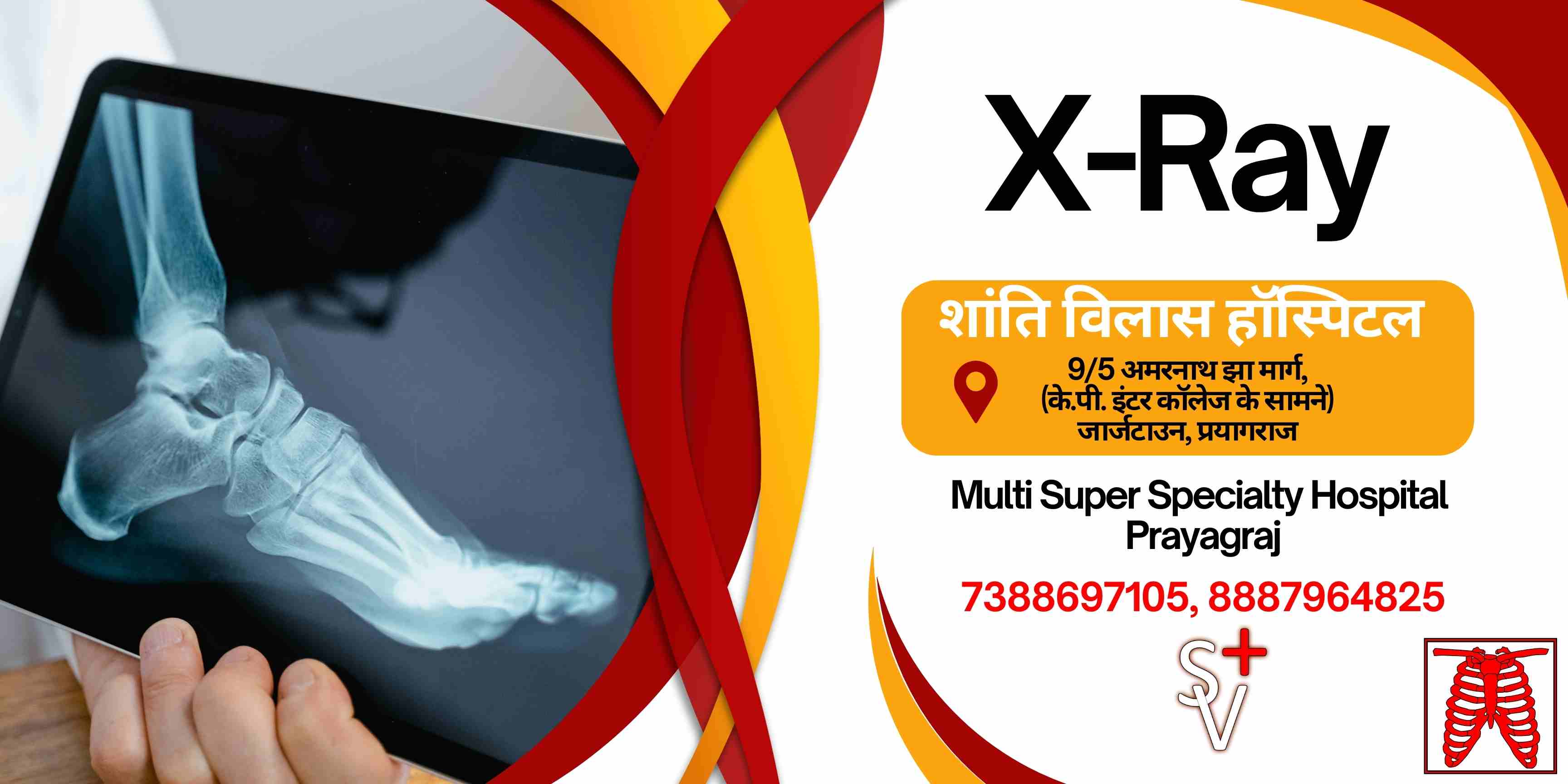 Welcome to Shanti Vilas Hospital - The Best X-ray Services in Prayagraj